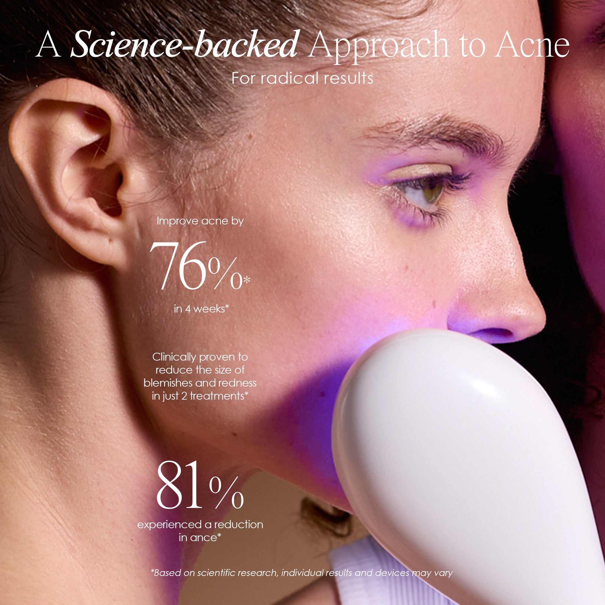 LumaGlow Blue | Anti-Acne LED Light Therapy Wand